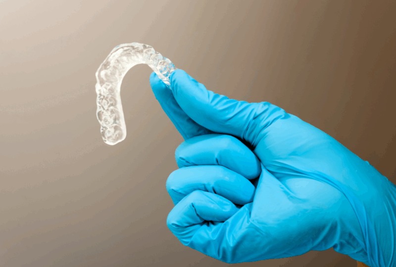 TMJ Splints: A Patient’s Guide