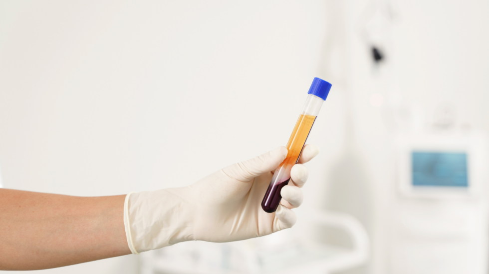 Platelet Rich Plasma (PRP)