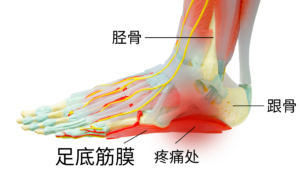 脚底板疼痛原因
