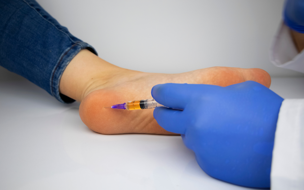 Platelet-Rich Plasma (PRP) Therapy 