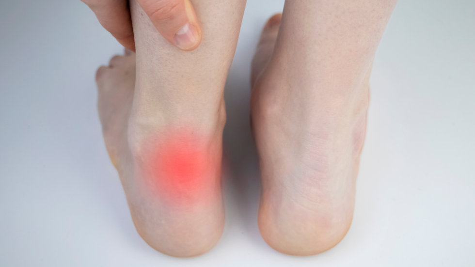 Achilles Tendon