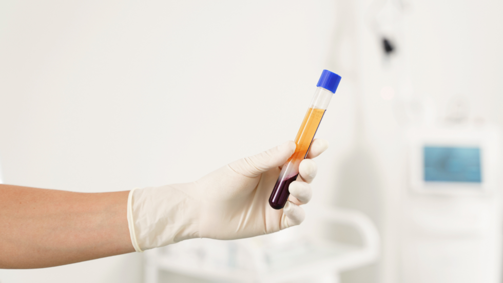 Platelet Rich Plasma Therapy 