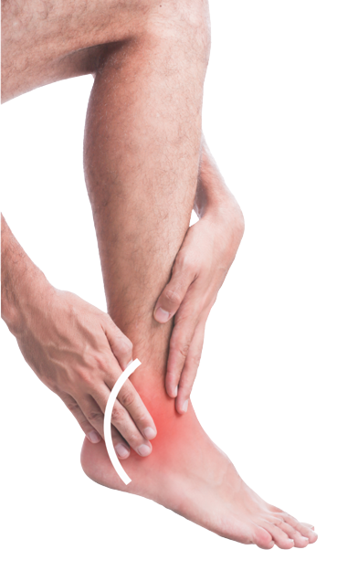 Achilles-Tendinitis Achilles-Tendinitis