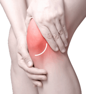 Knee-Pain Knee Pain