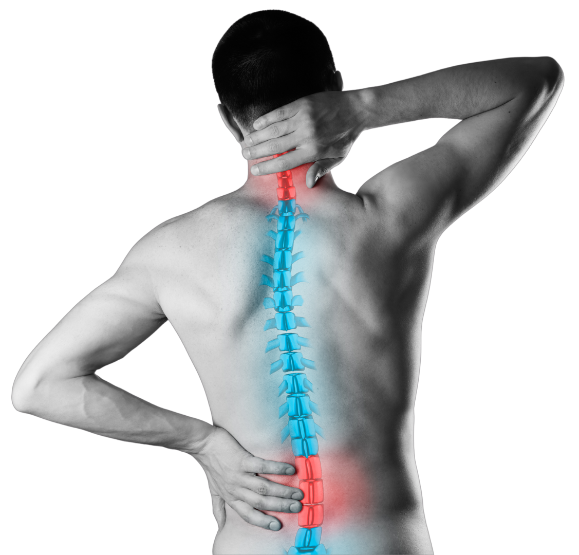 Neck Lower Back Spondylosis
