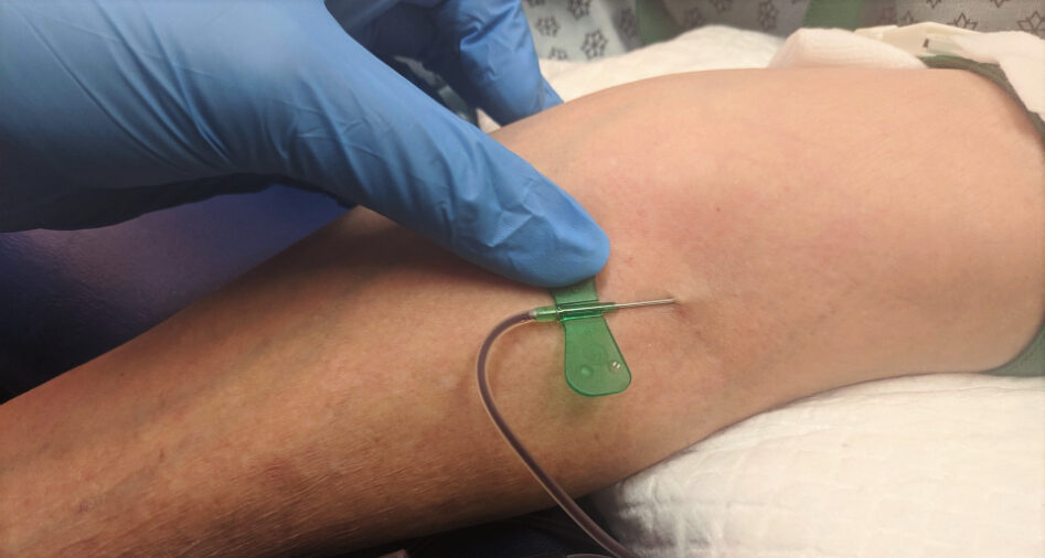 PRP-Blood-Draw Coreflex Injections