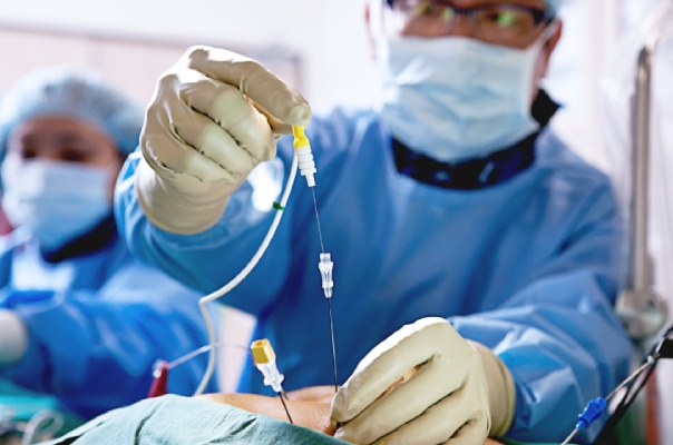 Radio Frequency Ablation Radiofrequency Ablation