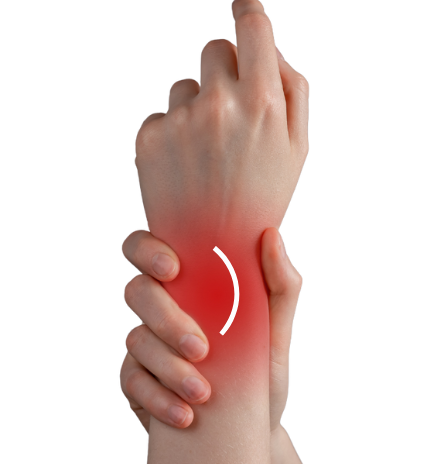 Wrist-Tenosynovitis Wrist Tenosynovitis