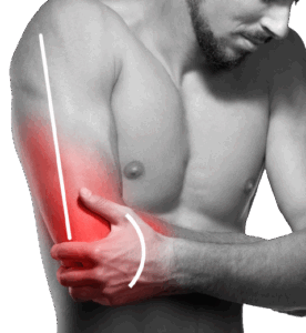 hand___arm_pain-removebg-preview arm pain
