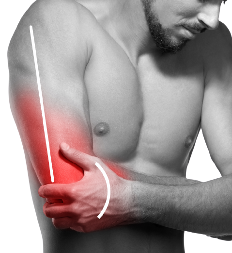 hand___arm_pain-removebg-preview arm pain