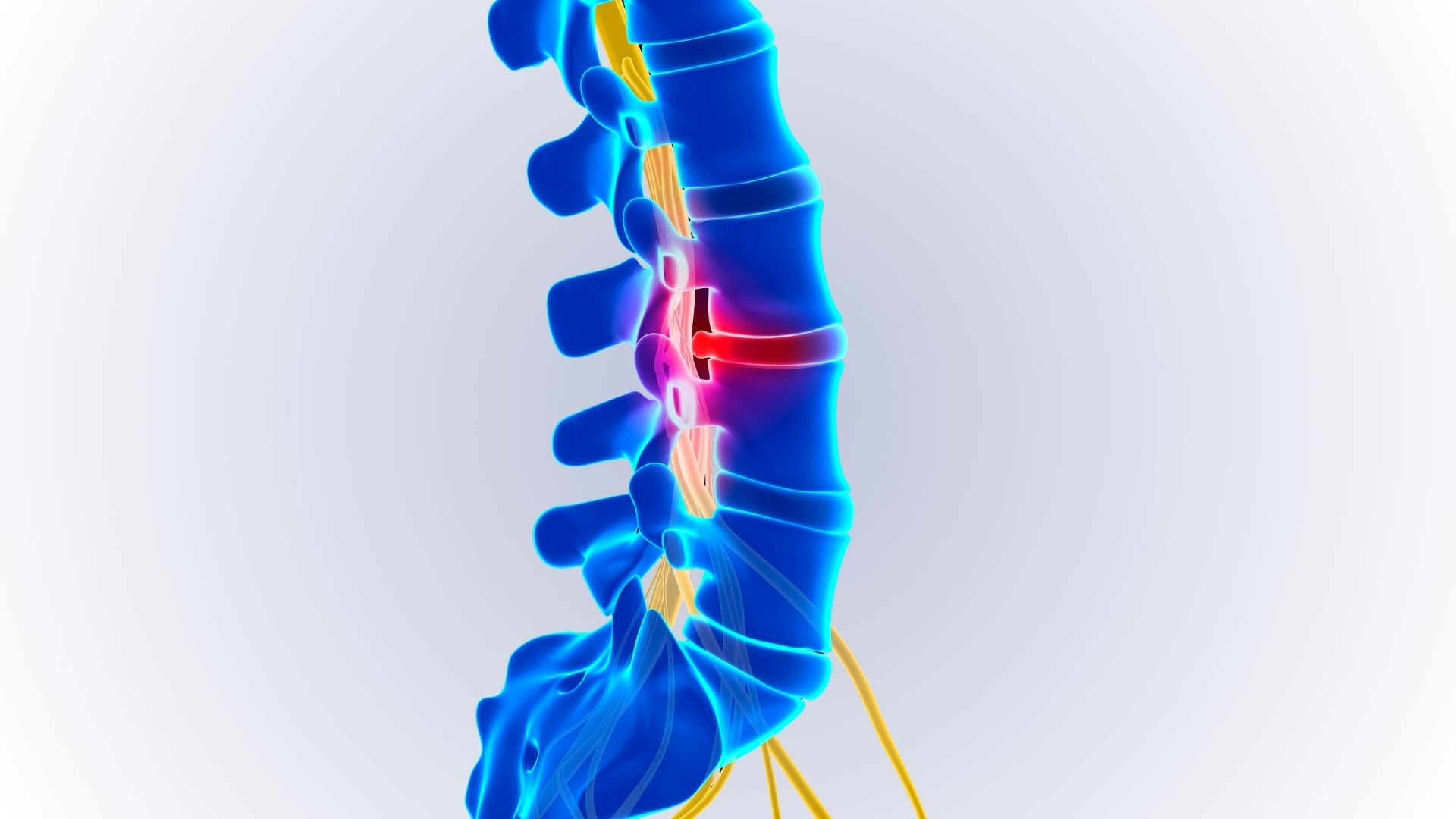 Dr. Bernard Lee Mun Kam on The Straits Times: Slipped Disc Without Surgery