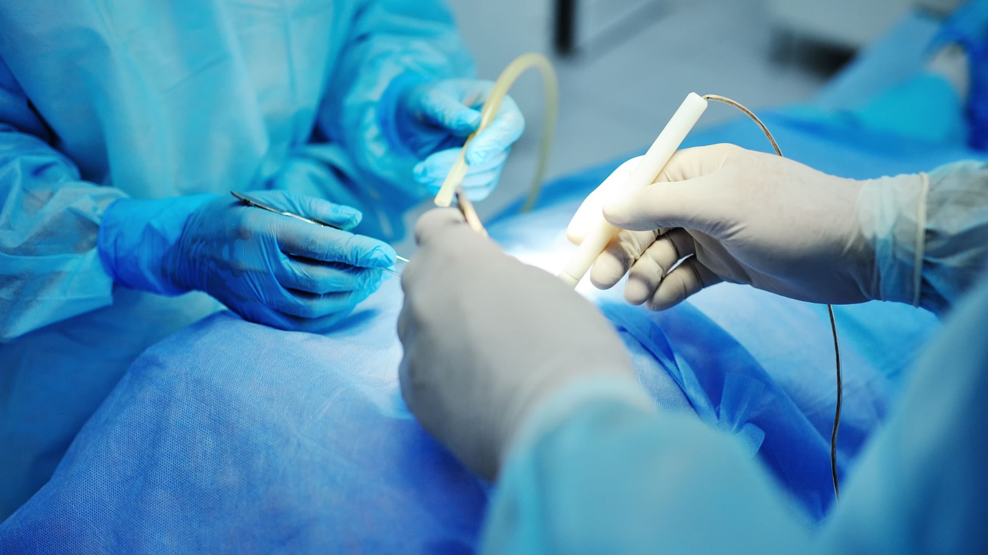 Is Sciatica Surgery the Only Option? Exploring Non-Surgical Treatment Options